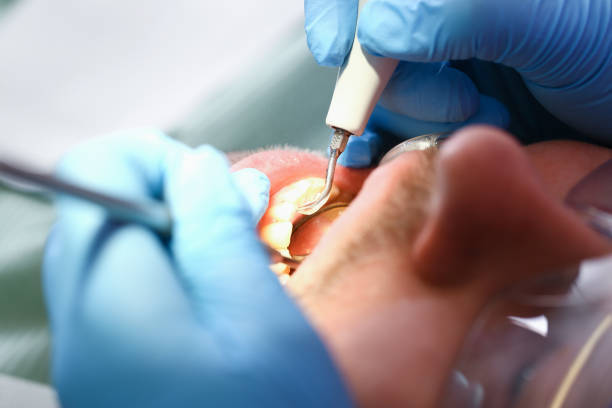 Best Dentist for Tooth Abscess  in Middlebush, NJ