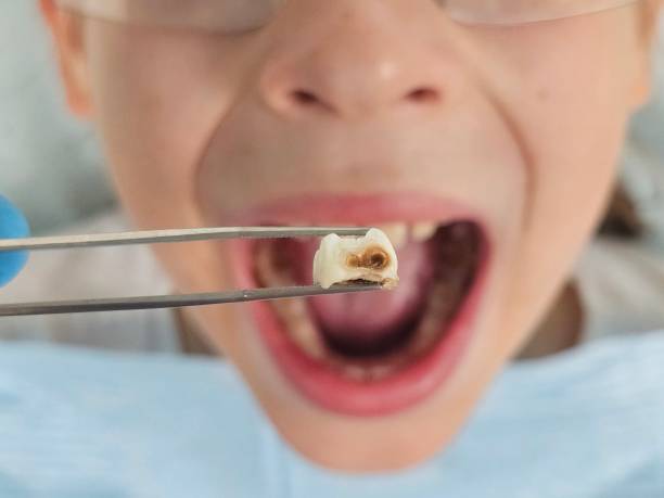 Best Emergency Dentist for Kids  in Middlebush, NJ